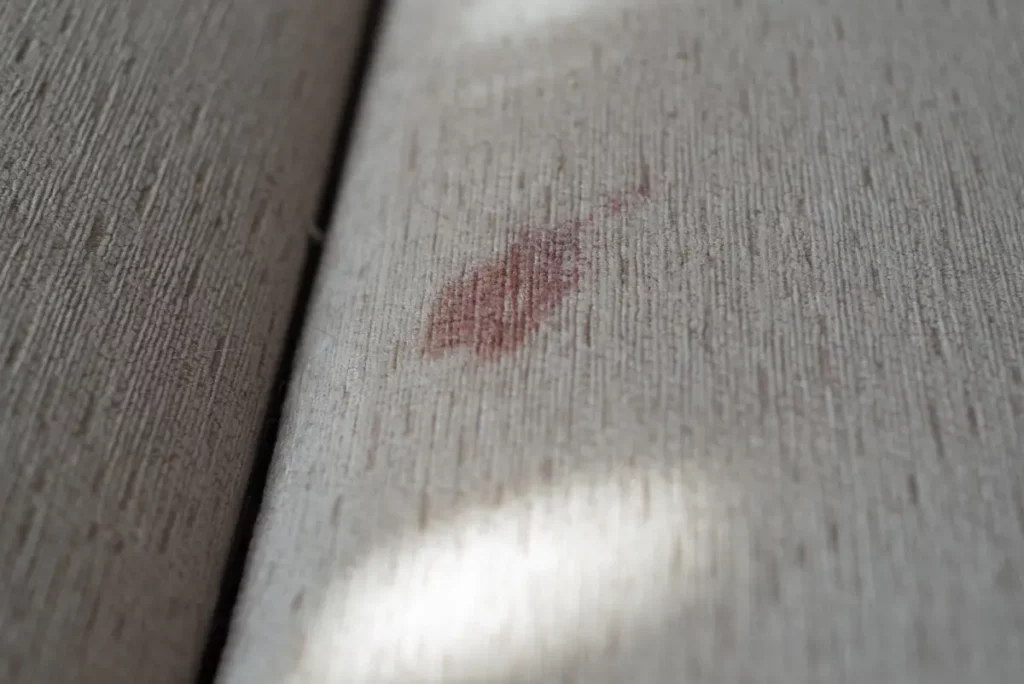 How to Get Dried Blood Out of a Sofa